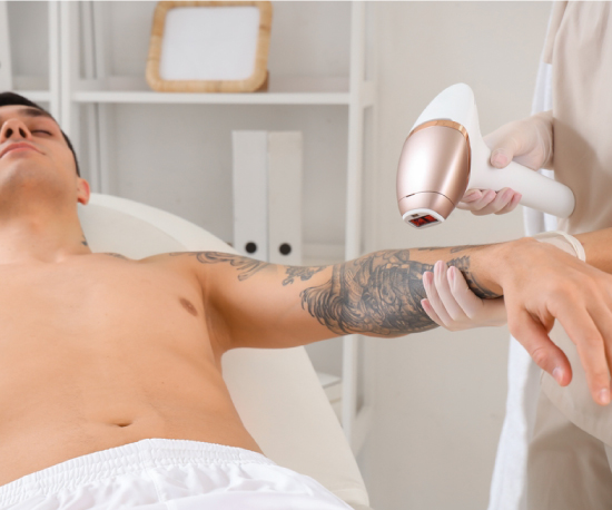 laser tattoo removal treatment