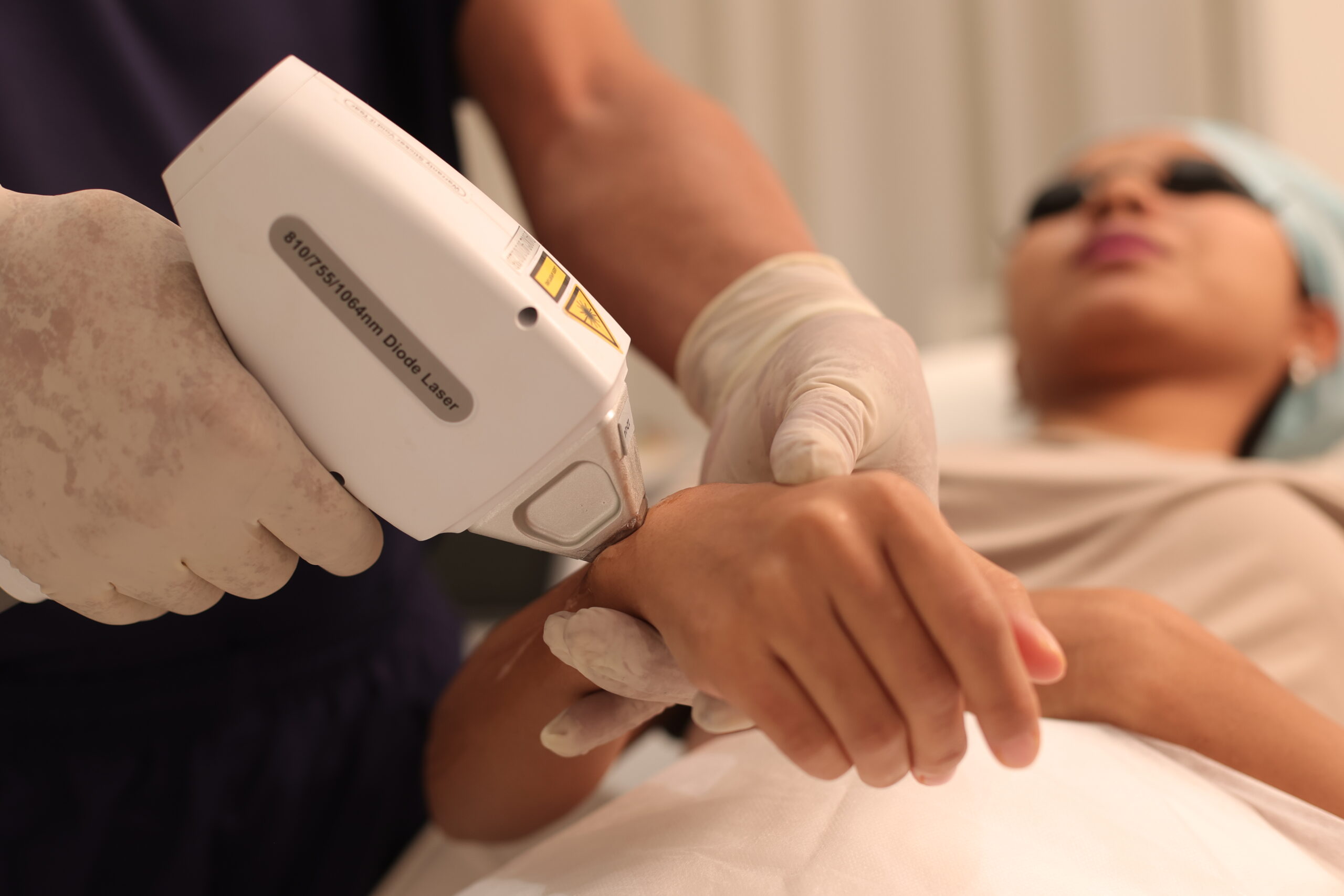 Professional laser hair reduction treatment